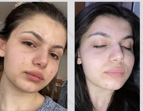 Customer photo review of SHE[A] RAW