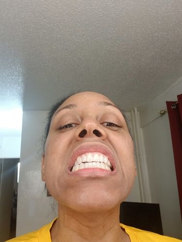 Customer photo review of BERRI-CLEAR+ 5 BERRY SUPERFRUIT SERUM