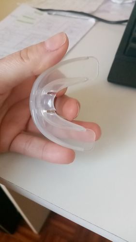 Customer photo review of InnoTeeth™ Dental Sleeping Brace