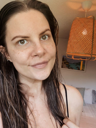Customer photo review of Freckle Stain