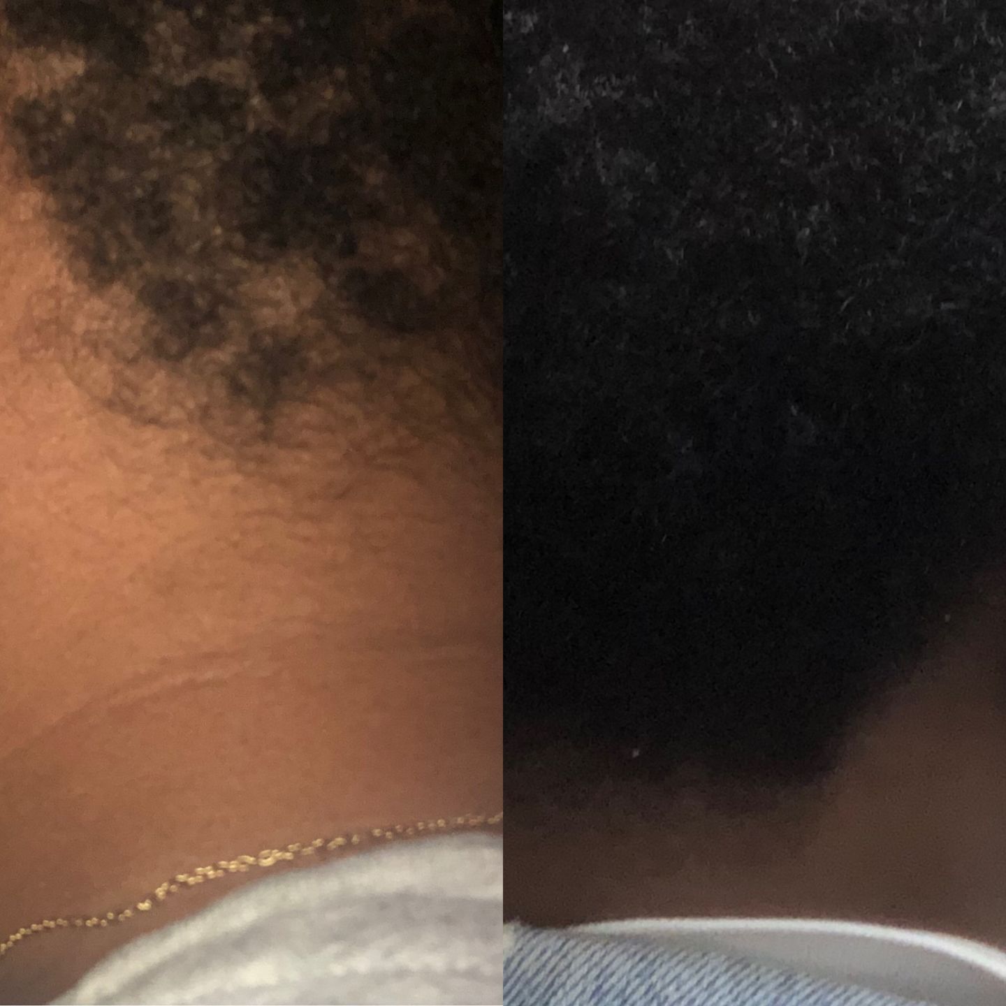 Customer photo review of INNER - VITAMINES POUR LES CHEVEUX - 1 MOIS