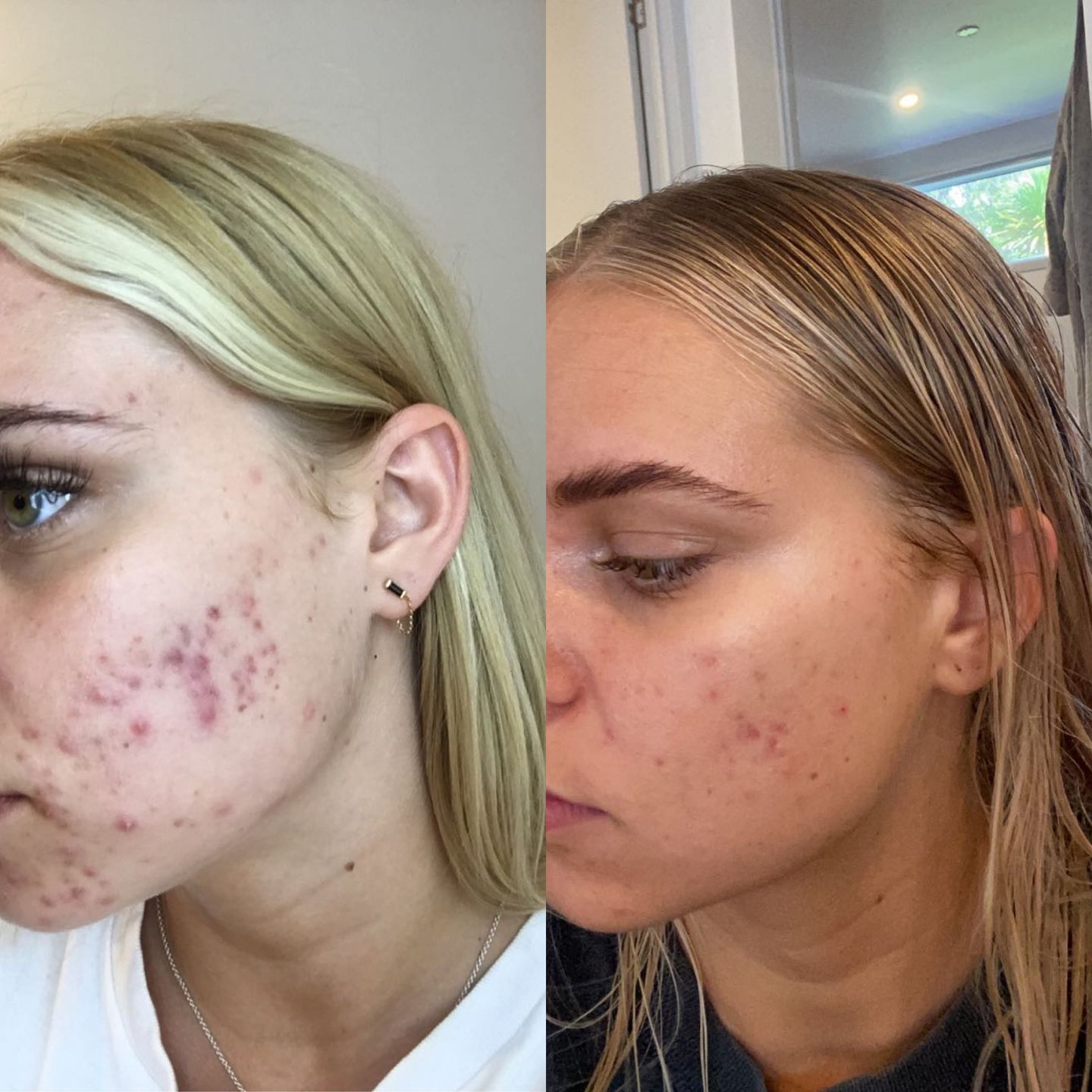 Customer photo review of Ultimate Face Oil (50ml)