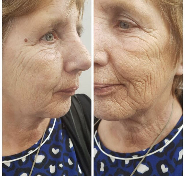 Recensione con foto di un cliente su SYNERGY FACE