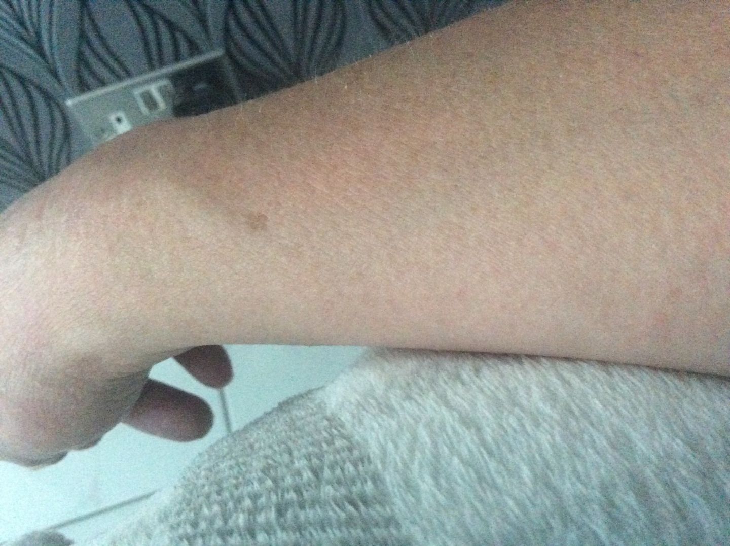 Customer photo review of Bioskin Zeoderm Skin Repair Moisturiser