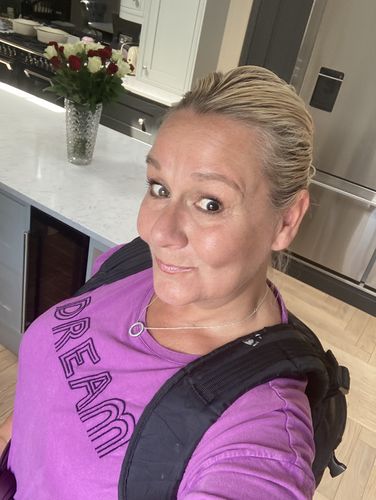 Customer photo review of Rosalique 3 in 1 Anti-Redness Miracle Formula SPF50