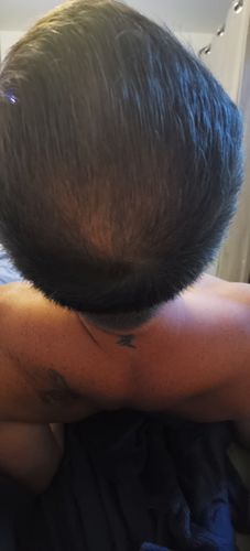 Customer photo review of KIT POUSSE CHEVEUX