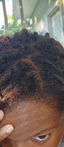 Customer photo review of Hair Growth Serum