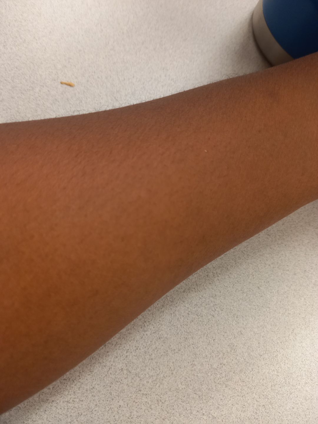 Customer photo review of Fair and White Exclusive Glycerin with Pure Vitamin "C" 250 ml / 8.4 fl oz