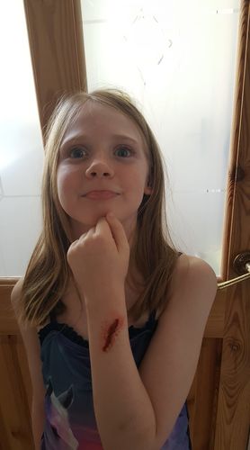 Customer photo review of Ben Nye 3D Special FX Makeup Kit