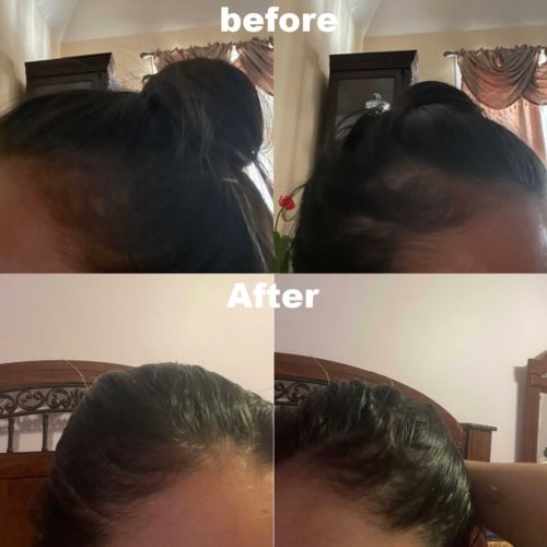 Customer photo review of Growth & Shine Hair Oil