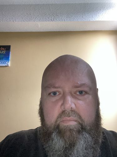 Customer photo review of GripXT™ - Grip Strengtheners (Free Giveaway)