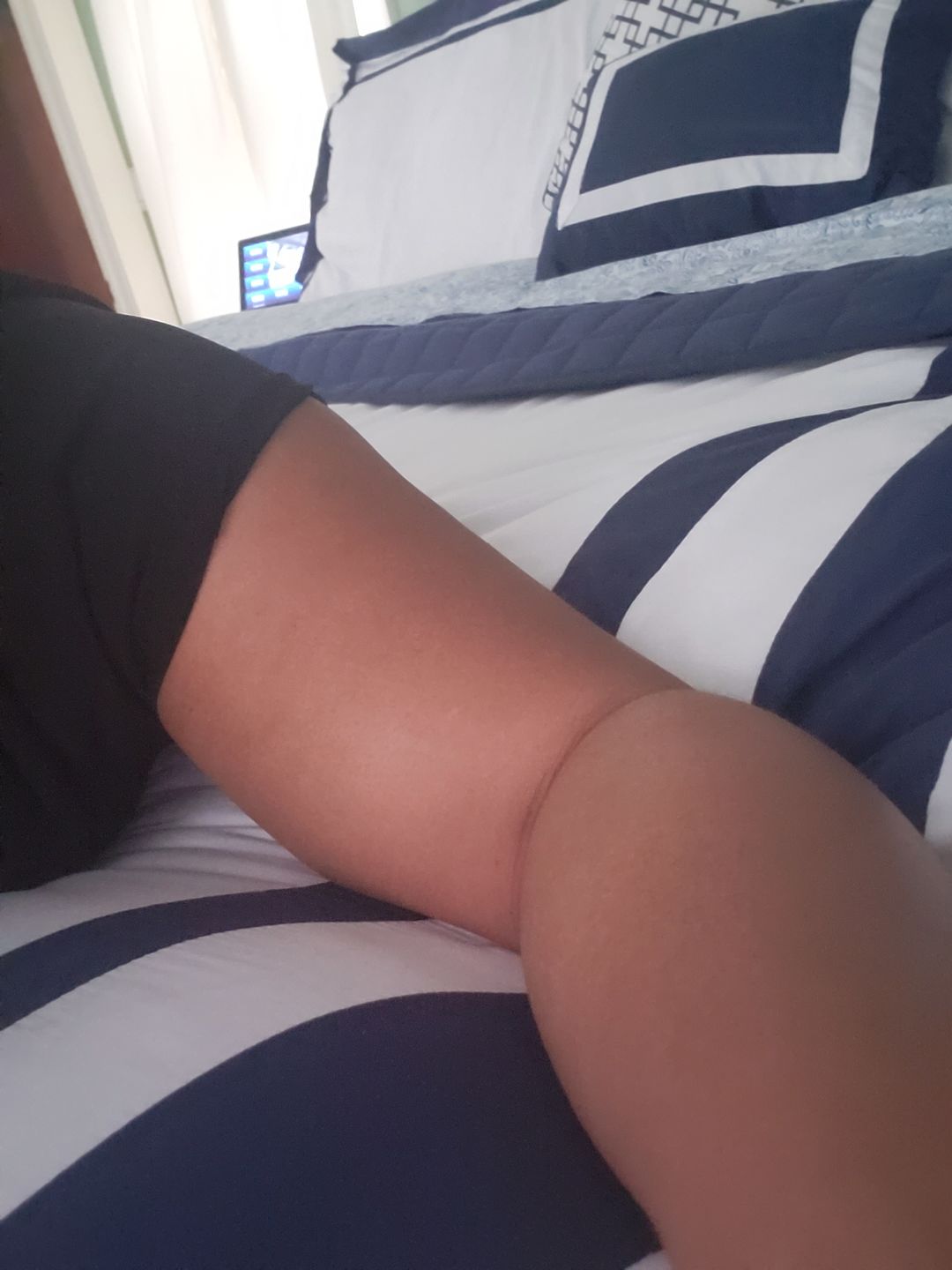 Customer photo review of Fair and White So White Skin Perfector Purifying Cream 250ml / 8.4 fl oz