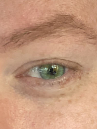 Customer photo review of Alpha Green Contact Lenses(12 months wear)