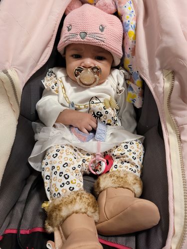 Customer photo review of LUXURY PACIFIER 3 YEAR WARRANTY - COVERS EVERYTHING