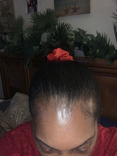 Customer photo review of Nae Nae's 9oz Hair Boost BOGO
