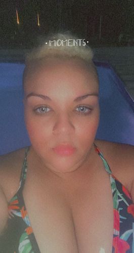 Customer photo review of Cynita Gray Contact Lenses(12 months wear)
