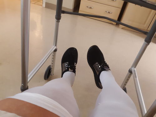 Customer photo review of Astra Sneakers - Instant Foot Pain Relief