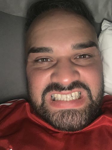 Customer photo review of SmileSecret® Refill Pens