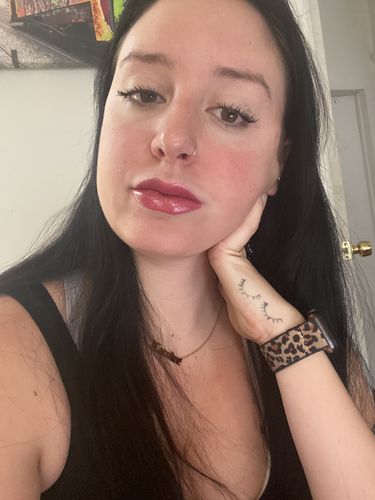 Customer photo review of LipFix: Filler