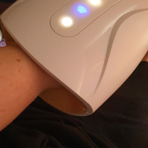 Customer photo review of HandCare+ Regeneráló Kézmasszírozó