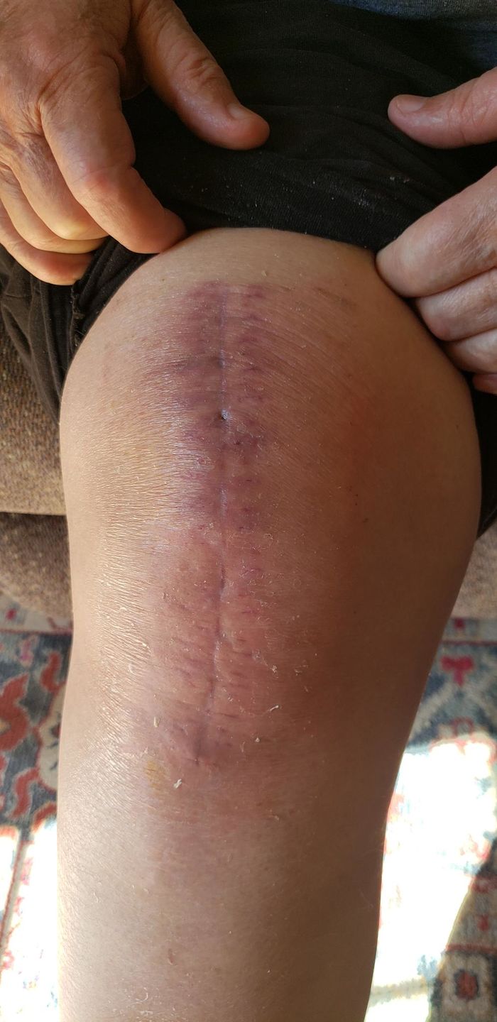 Customer photo review of Combat Ready Ointment - Big Tin