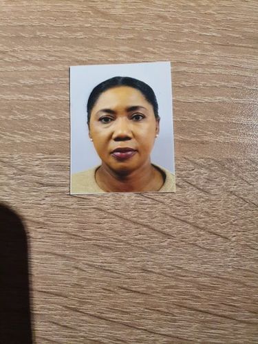 Customer photo review of X Factor Hair Growth Oil