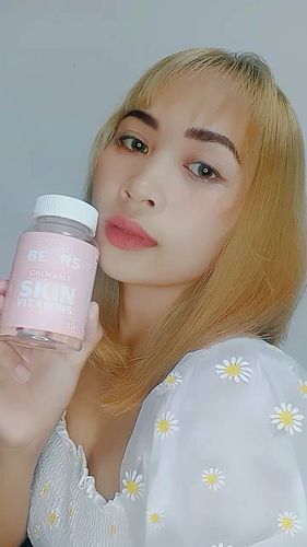 Customer photo review of Skin Vitamin Gummies