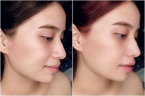 Customer photo review of Skin Vitamin Gummies