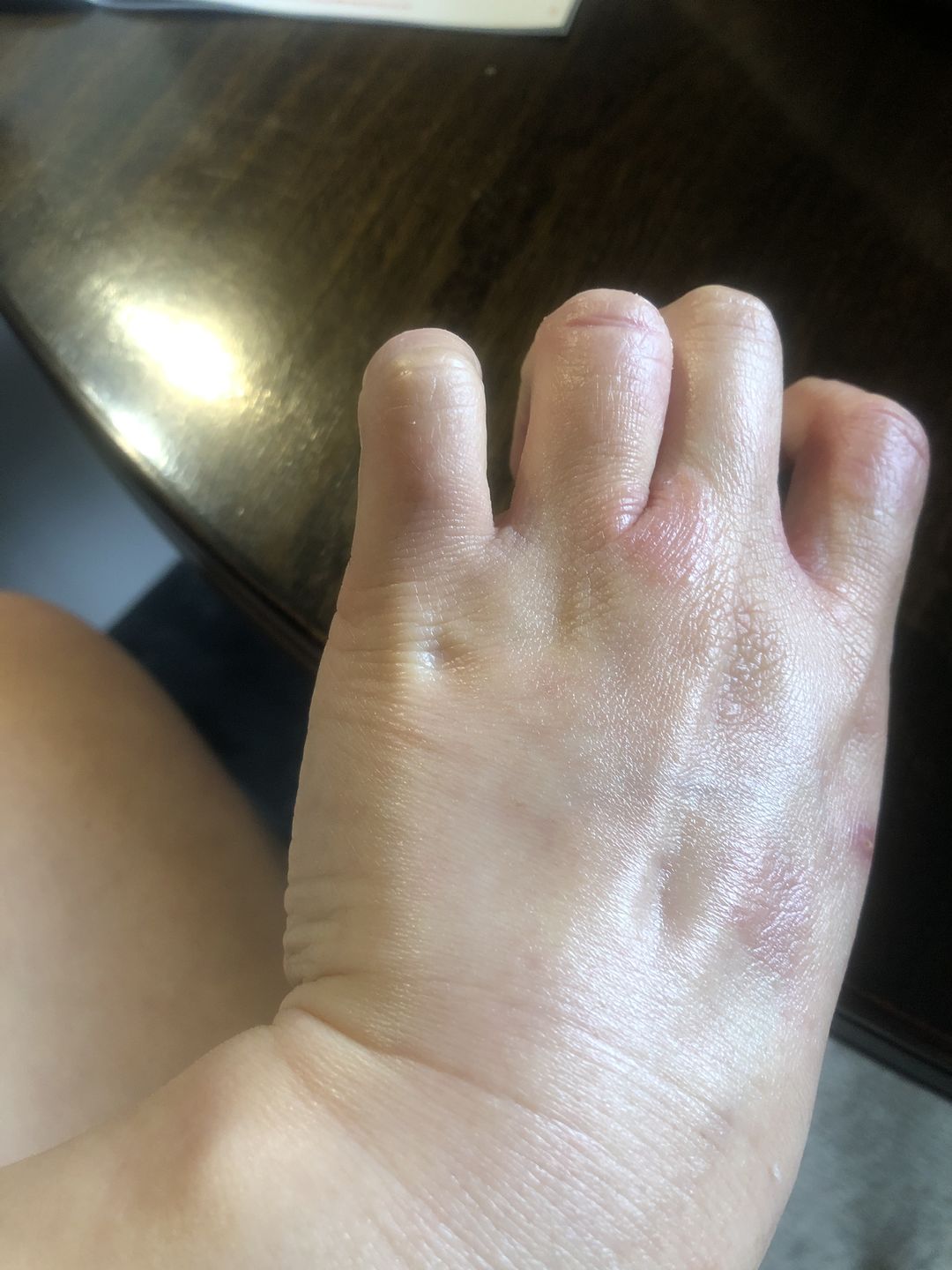 Customer photo review of Kawakawa Body Oil