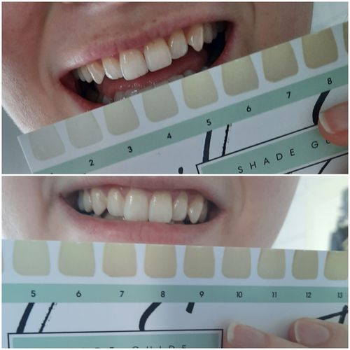 Customer photo review of Refill Bundle