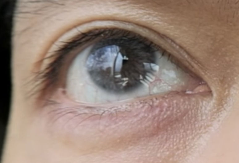 Customer photo review of Siesta Crystal Iris Gray