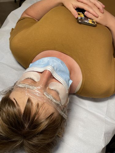 Customer photo review of Zensa Topical Numbing Cream