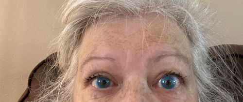 Customer photo review of Pixie Blue Prescription Contact Lenses