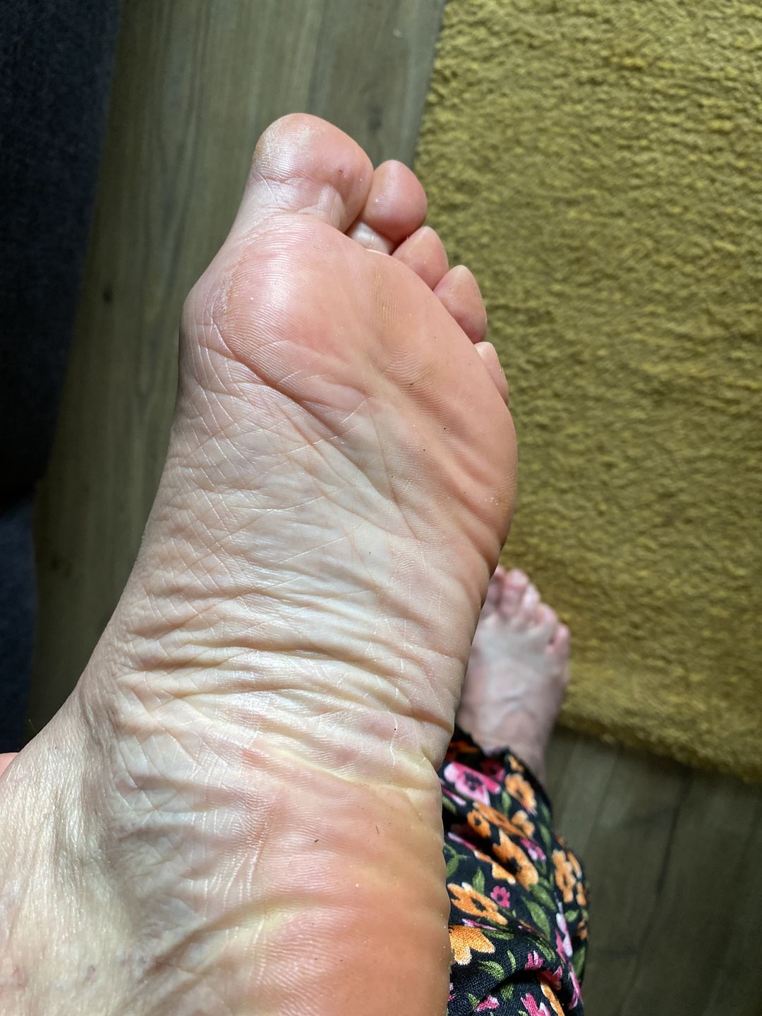 Customer photo review of LOVASKIN INSTANT FOOT PEEL Spray bottle 2.5 fl oz - 25 uses or under 2 $ to have beautiful feet
