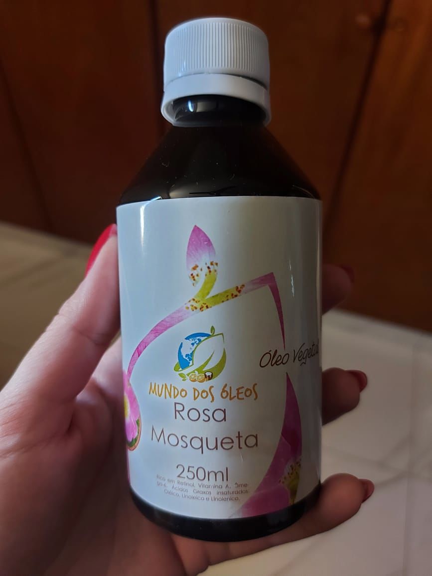 Customer photo review of Óleo de Rosa Mosqueta