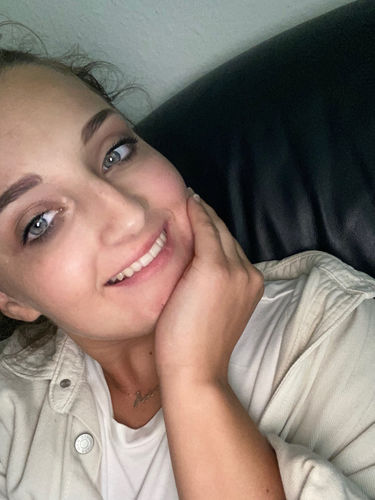 Customer photo review of PAP+ LED Teeth Whitening Kit