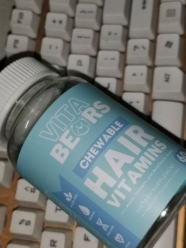 Customer photo review of Hair Vitamin Gummies
