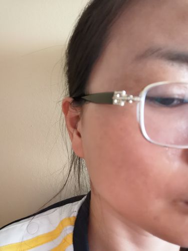 Customer photo review of TriPollar STOP Vx