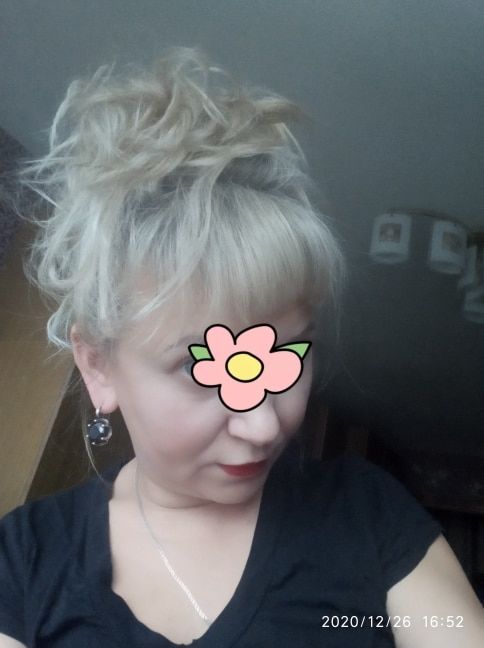 Customer photo review of Messy Bun Scrunchies Ponytail Holder Hair Pieces For Women