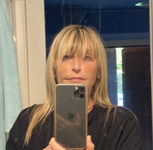 Customer photo review of Acido Ialuronico Puro - Idratante, Rimpolpante, Antirughe, 30ml