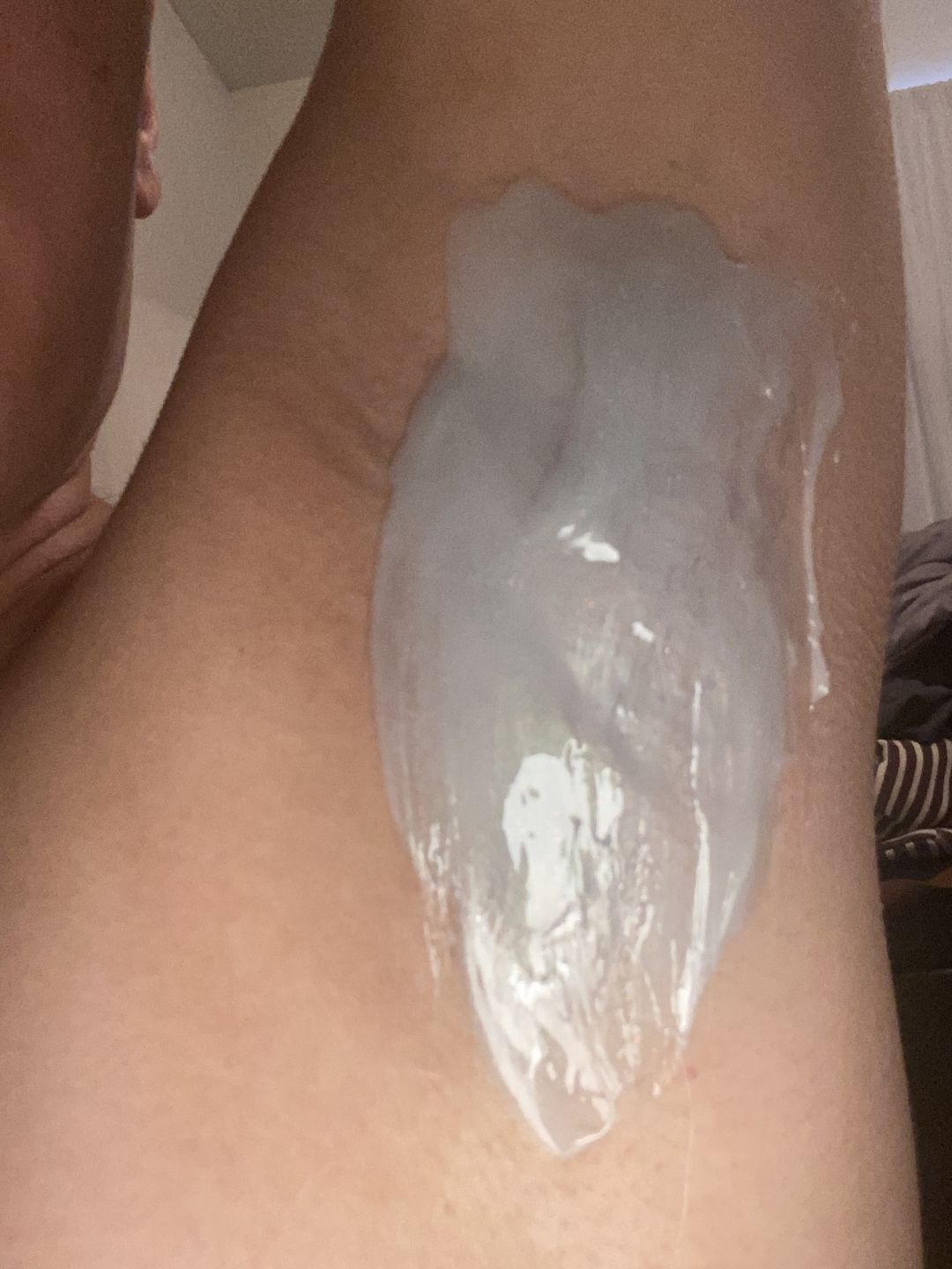 Customer photo review of At-Home Signature Series Hair Removal Wax