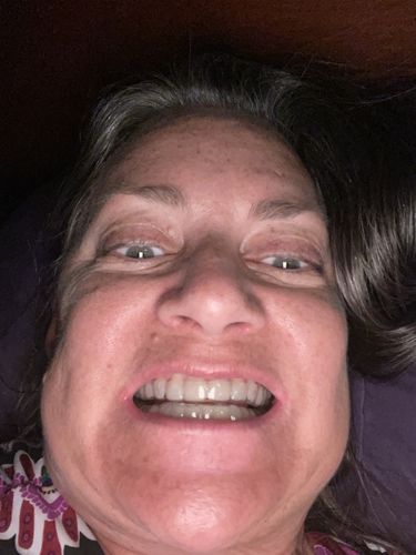 Customer photo review of Night Guard - Yearly