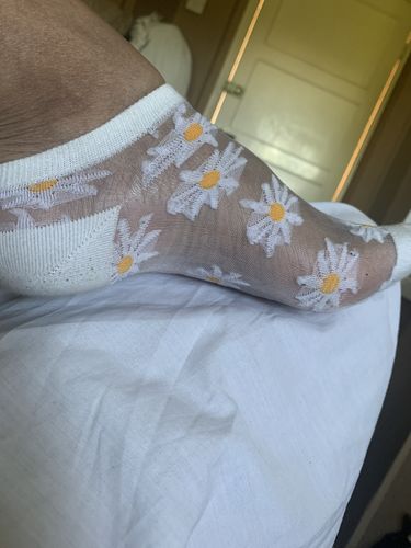 Customer photo review of 🔥Summer Mesh Breathable Elastic Lace Socks