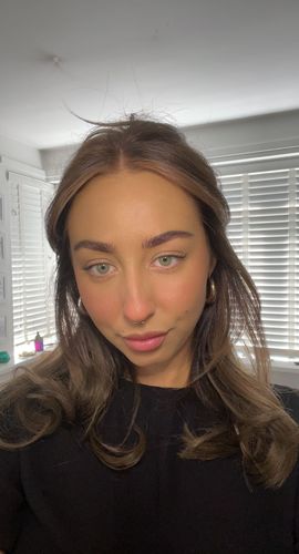 Customer photo review of Vision Green Contact Lenses(12 months wear)