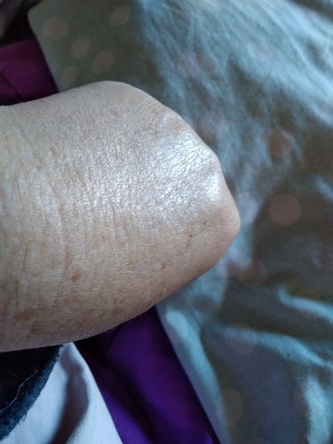 Customer photo review of Antiox+