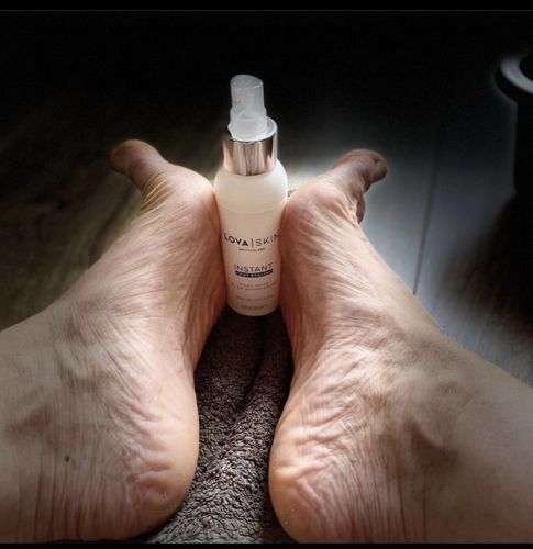 Customer photo review of LOVASKIN INSTANT FOOT PEEL Essential Kit - Great value, 25 uses in one bottle