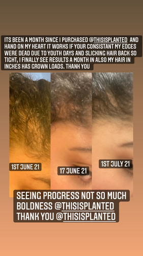 Customer photo review of Inches - Hair & Beard Oil