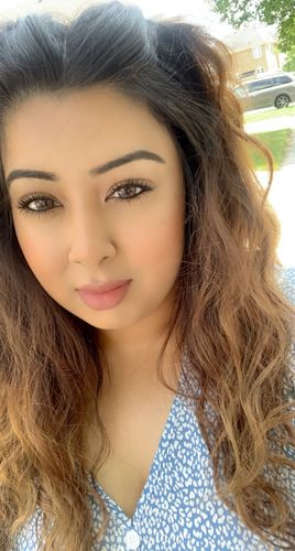 Customer photo review of Neala Brown Contact Lenses(12 months wear)