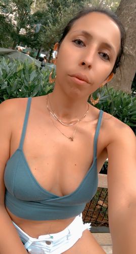 Customer photo review of Elite Snow Flake Contact Lenses