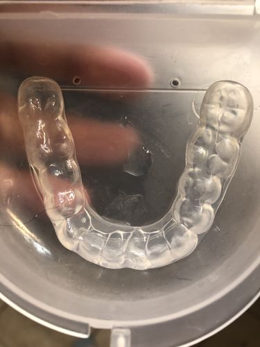 Customer photo review of Impression Kit (Ships every 3 Months)